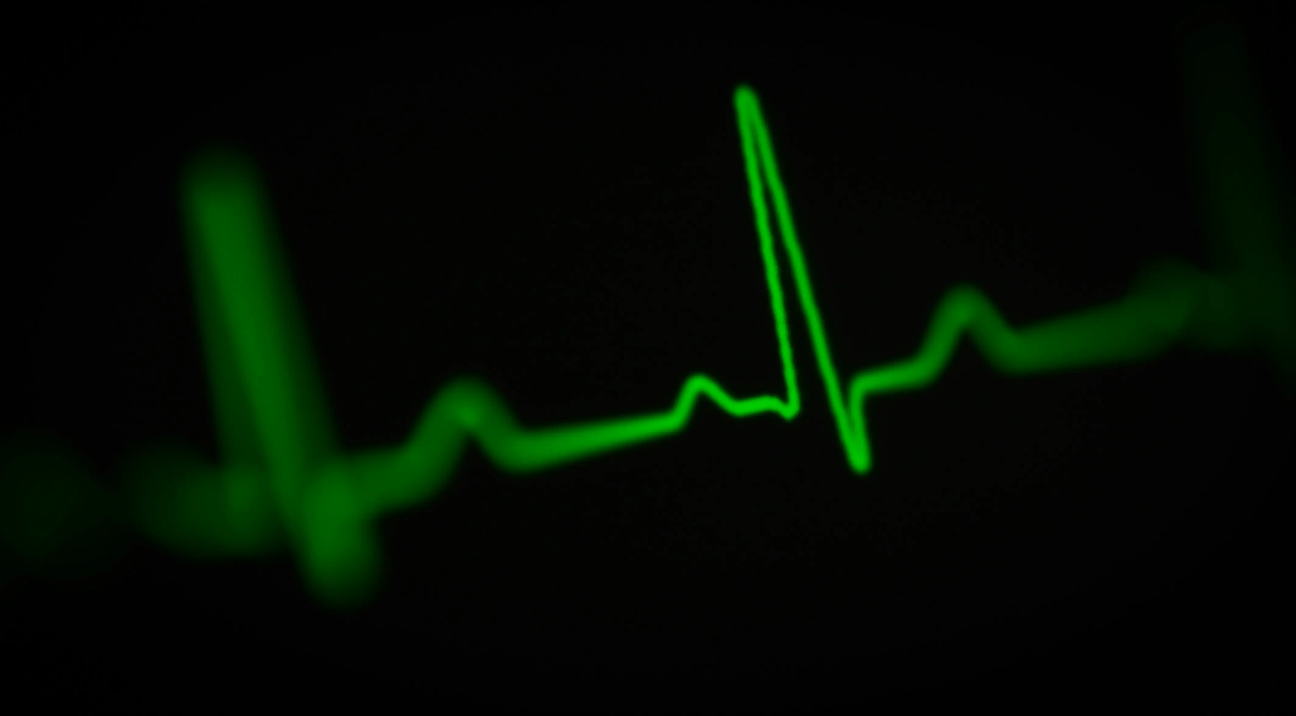 Estatinas e ezetimiba, logo após um ataque cardíaco pode reduzir significativamente o risco de novos eventos cardiovasculares, como infarto e derrame (Foto: Unsplash)